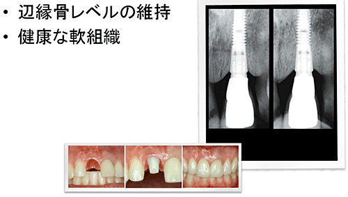 �����ɂ킽��ω����Ȃ��R������