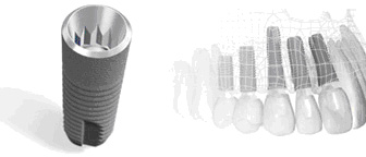 �C���v�����g