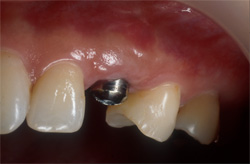 �C���v�����g�Ǘ�