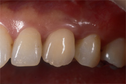 �C���v�����g�Ǘ�