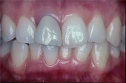 �C���v�����g�Ǘ�