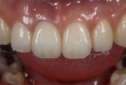 �C���v�����g�Ǘ�