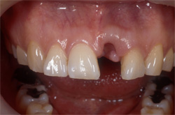 �C���v�����g�Ǘ�