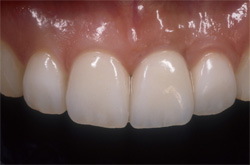 �C���v�����g�Ǘ�