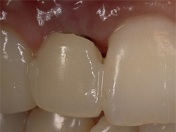 �C���v�����g�Ǘ�