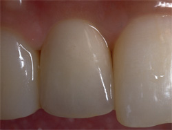 �C���v�����g�Ǘ�