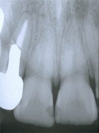 �C���v�����g�Ǘ�