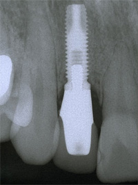 �C���v�����g�Ǘ�