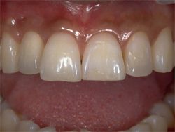 �C���v�����g�Ǘ�