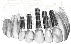 �A�X�g���e�b�N�C���v�����g