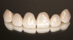 �I�[���Z���~�b�N�X�i�L���X�^�u���Z���~�b�N�X�j