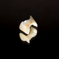 �n�C�u���b�h�E�C�����[