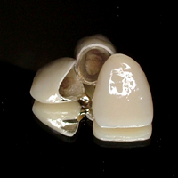 �n�C�u���b�g�O����